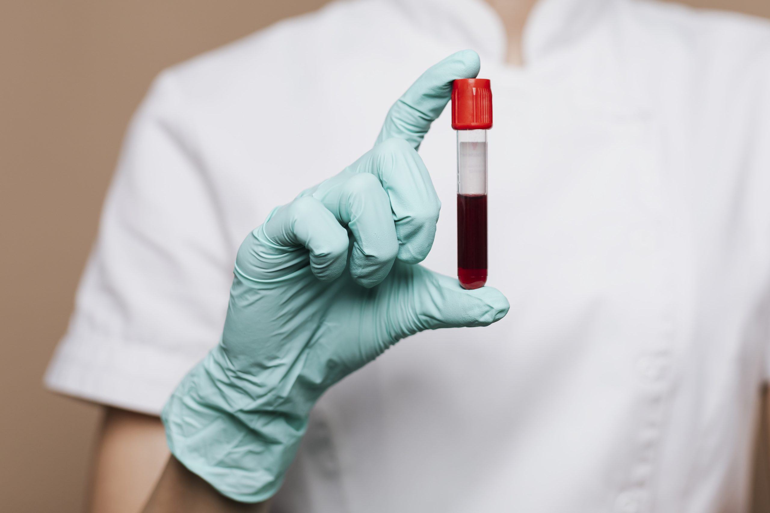 Venipuncture